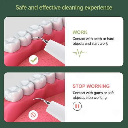 Dental Scaler | Ultrasonic Plaque Remover Tool for Home