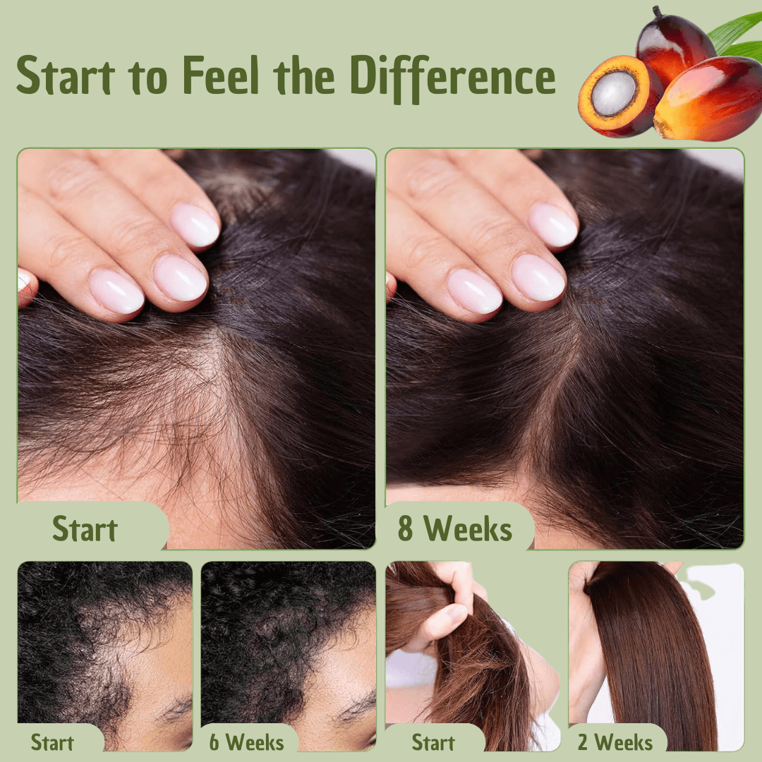 Batana Hair Oil – Natural UV Protection & Environmental Shield for Healthy Hair