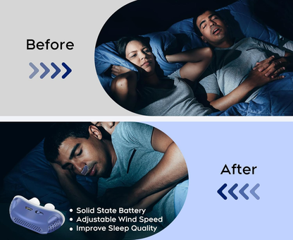 Anti Snoring Device Rechargeable Nasal CPAP Aid