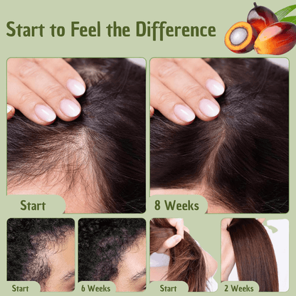 Batana Hair Oil – Natural UV Protection & Environmental Shield for Healthy Hair